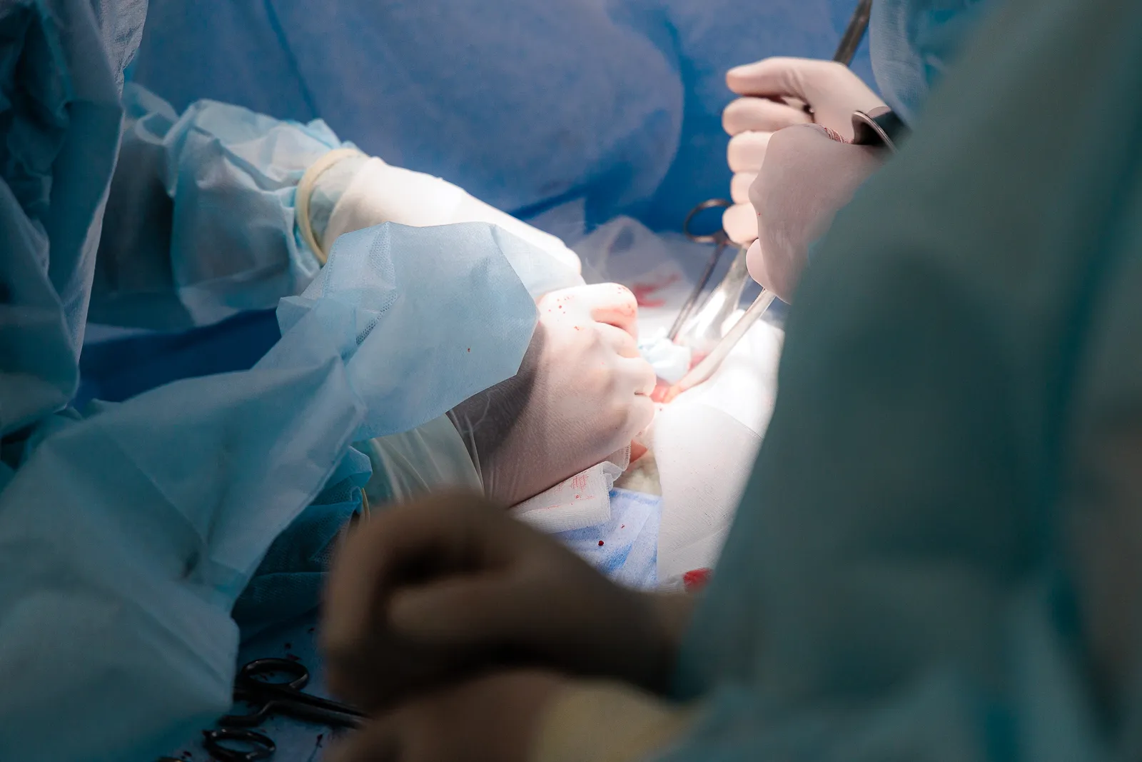 Запущенный перитонит: как игнорирование боли чуть не стоило жизни.